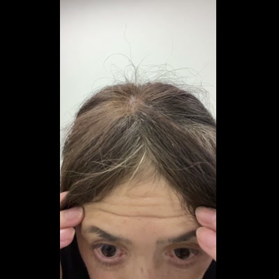 おでこのシワをうつす50代女性｜美容